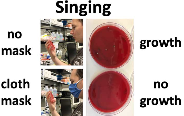 TSA BLood Agar plates comparing results from singing with and without a mask.