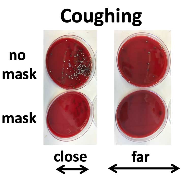 TSA BLood Agar plates comparing results from coughing with and without a mask.