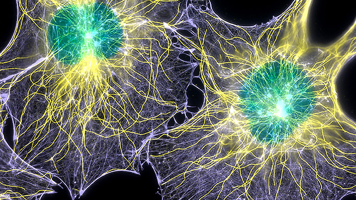 wittmann cells