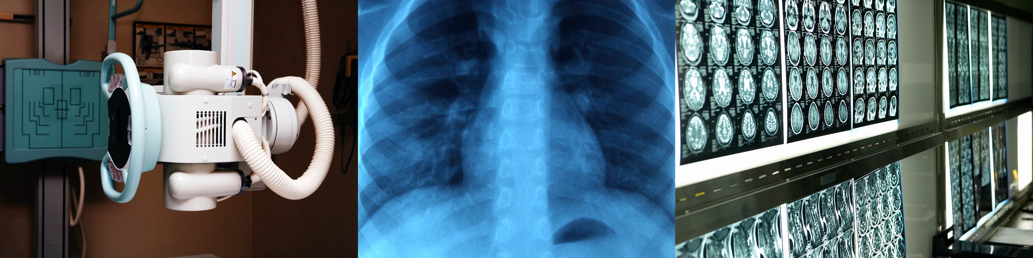UAH-P-13018-Non-Intrusive X-ray Imaging System for Mammograms and Other Medical Applications